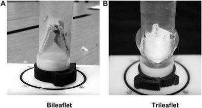 In vitro Assessment of the Impacts of Leaflet Design on the Hemodynamic Characteristics of ePTFE Pulmonary Prosthetic Valves